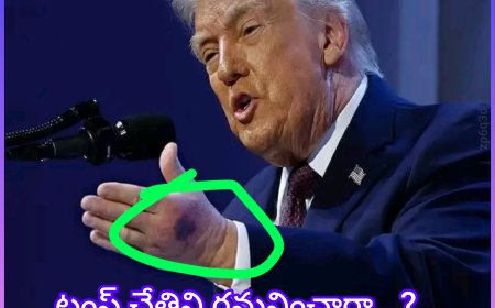 దావోస్ విమాన సమస్య తర్వాత ట్రంప్ చేతిపై గాయం..... ట్రంప్  కి ఏం జరుగుతుంది. ?